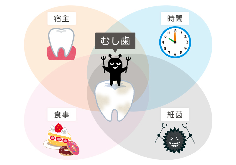 むし歯の原因